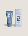 Before - Whitening Toothpaste